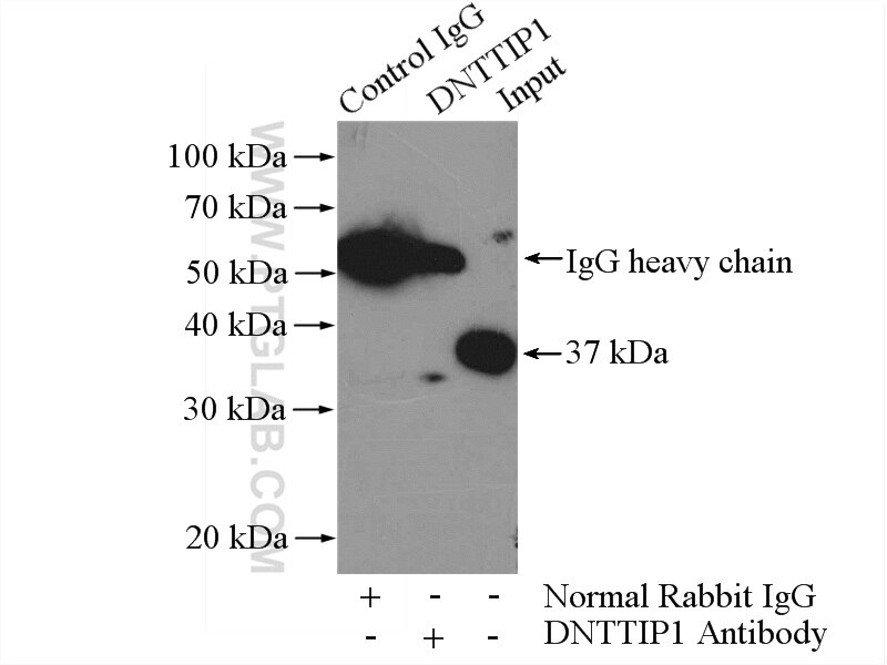 Immunoprecipitation (IP) experiment of HeLa cells using DNTTIP1 Polyclonal antibody (11637-1-AP)