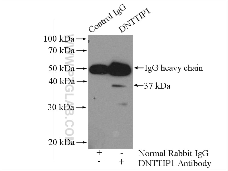 IP experiment of HeLa using 11637-1-AP