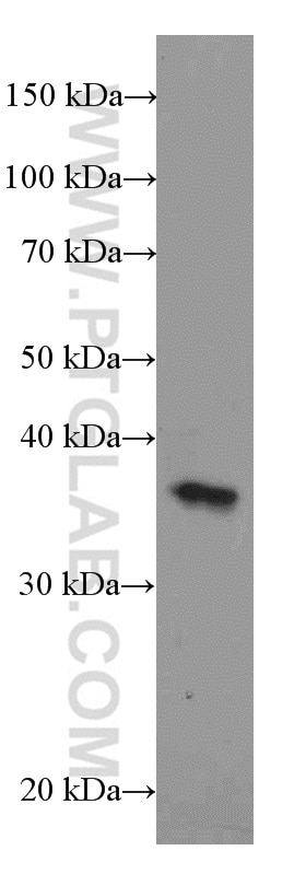 Western Blot (WB) analysis of HeLa cells using DNTTIP1 Polyclonal antibody (11637-1-AP)