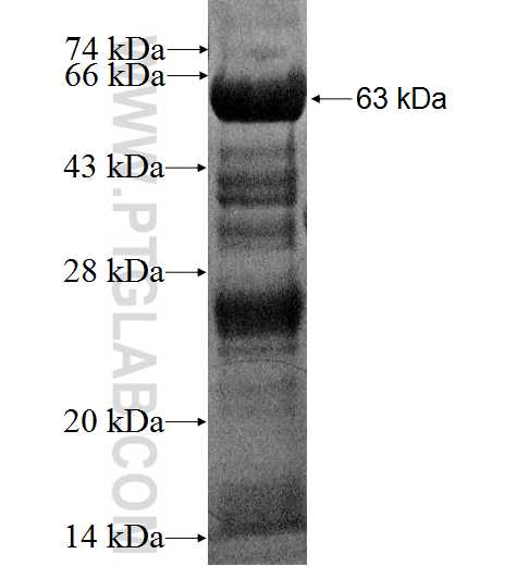 DNTTIP1 fusion protein Ag2213 SDS-PAGE