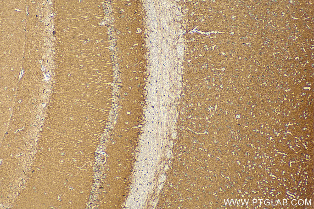 Immunohistochemistry (IHC) staining of mouse brain tissue using DOC2A Polyclonal antibody (20575-1-AP)