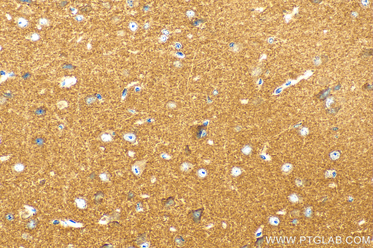 Immunohistochemistry (IHC) staining of mouse brain tissue using DOC2A Polyclonal antibody (20575-1-AP)