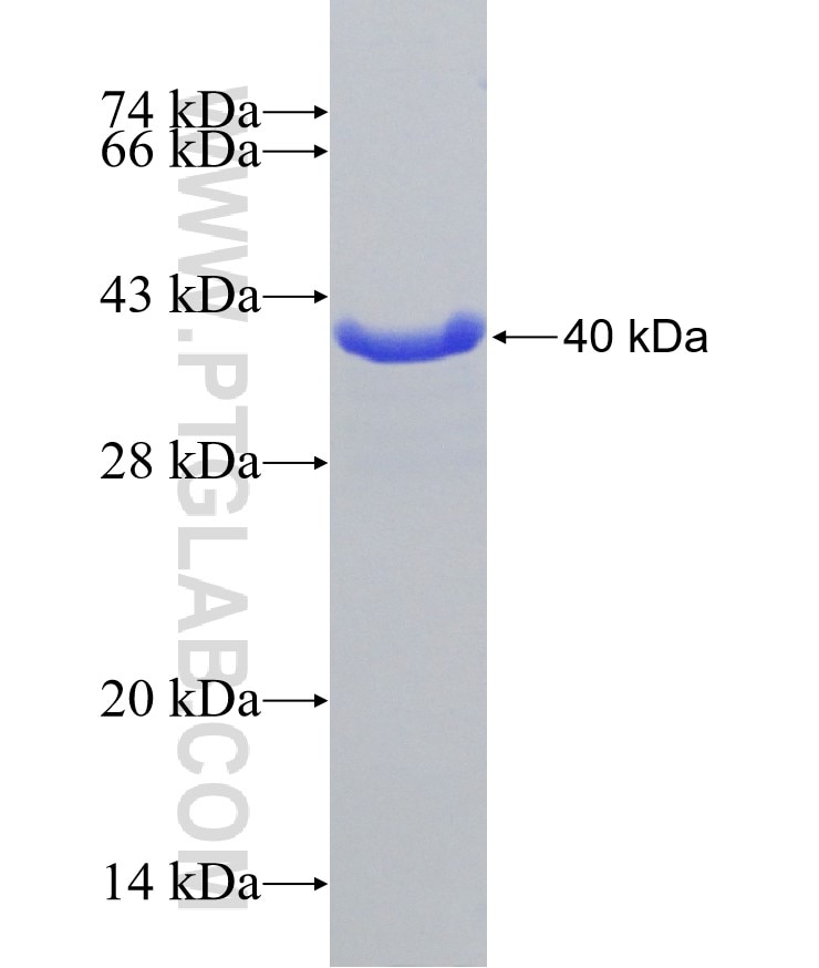DOC2A fusion protein Ag31184 SDS-PAGE