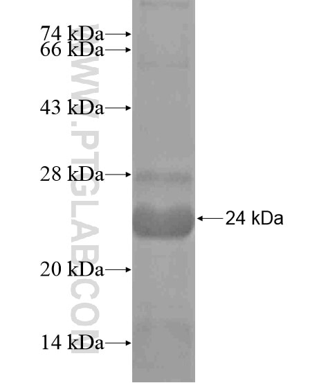 DOC2B fusion protein Ag18684 SDS-PAGE
