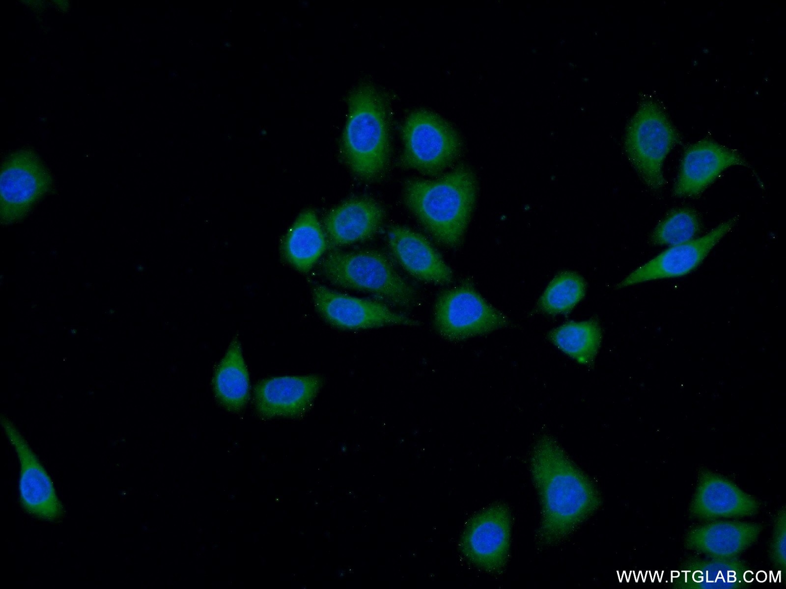 Immunofluorescence (IF) / fluorescent staining of HeLa cells using DOCK180 Polyclonal antibody (23421-1-AP)