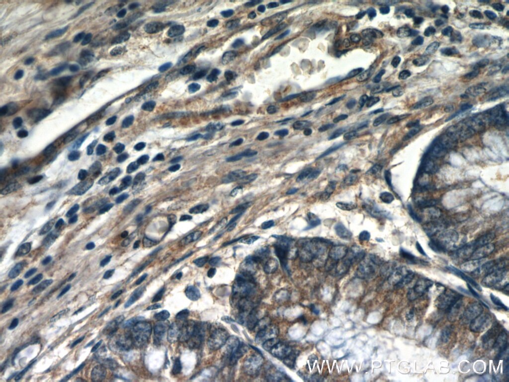 Immunohistochemistry (IHC) staining of human colon tissue using DOCK180 Polyclonal antibody (23421-1-AP)