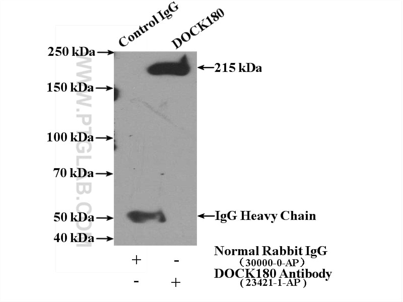 Immunoprecipitation (IP) experiment of HeLa cells using DOCK180 Polyclonal antibody (23421-1-AP)