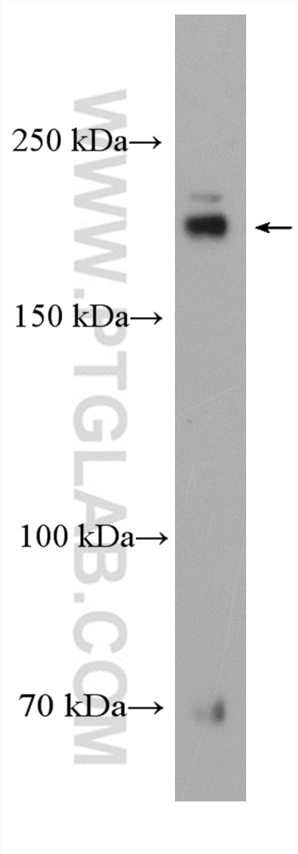 Western Blot (WB) analysis of LNCaP cells using DOCK180 Polyclonal antibody (23421-1-AP)