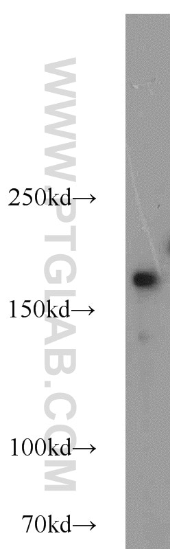 Western Blot (WB) analysis of HeLa cells using DOCK180 Polyclonal antibody (23421-1-AP)