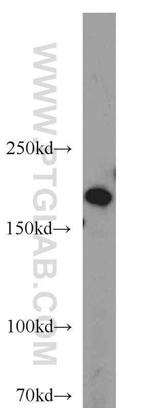 Western Blot (WB) analysis of HEK-293 cells using DOCK180 Polyclonal antibody (23421-1-AP)