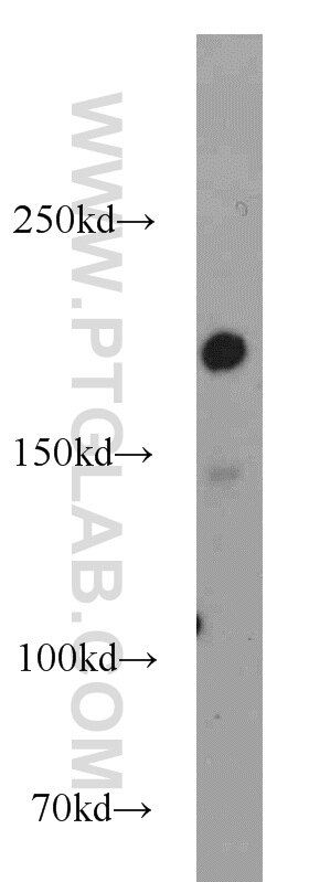 Western Blot (WB) analysis of A431 cells using DOCK180 Polyclonal antibody (23421-1-AP)