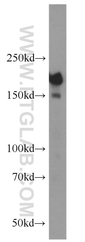Western Blot (WB) analysis of MCF-7 cells using DOCK180 Polyclonal antibody (23421-1-AP)