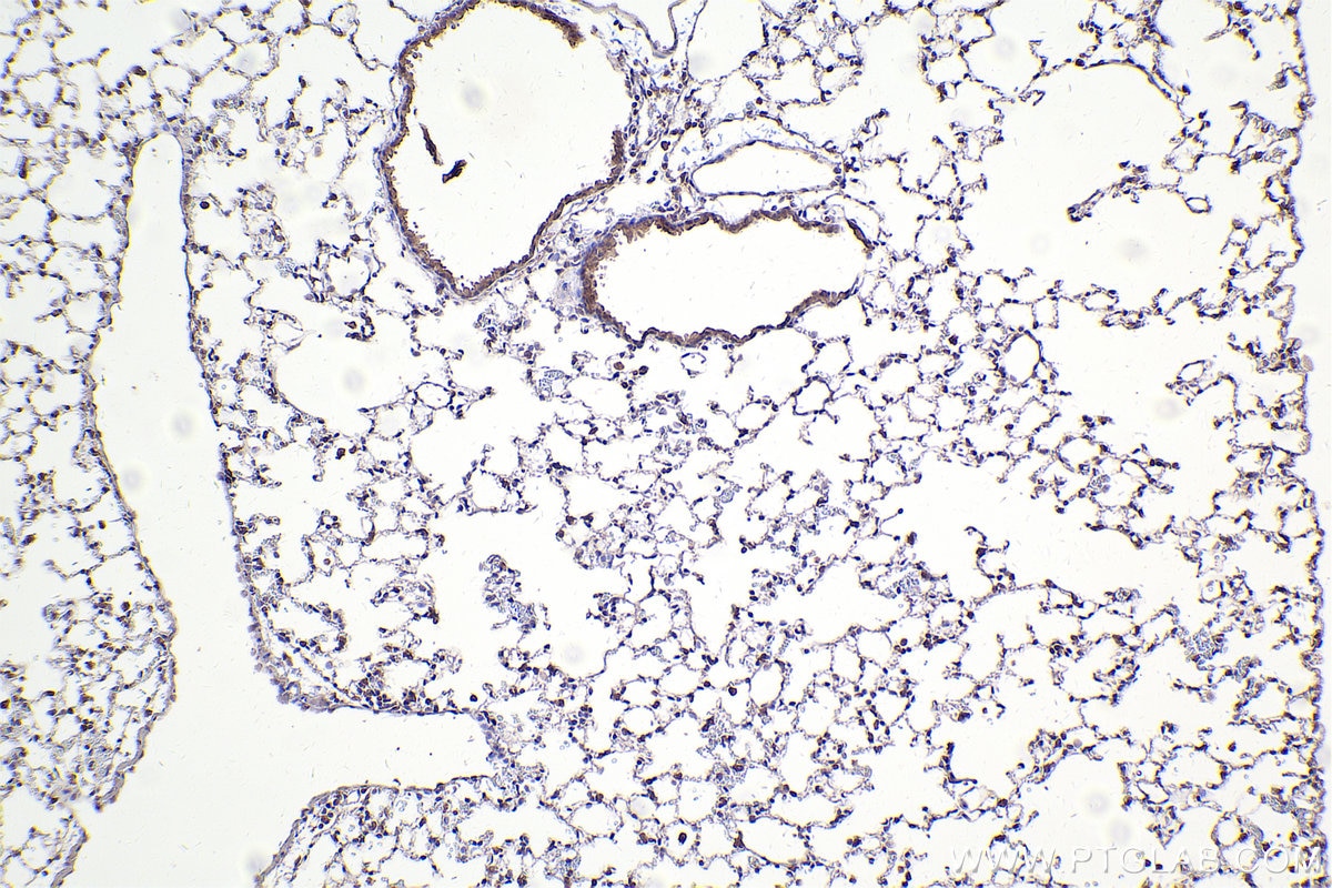 IHC staining of mouse lung using 67296-1-Ig (same clone as 67296-1-PBS) Immunohistochemistry (IHC) staining of mouse lung tissue using DOCK1 Monoclonal antibody (67296-1-Ig)