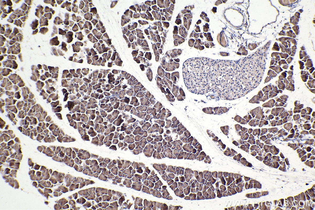 IHC staining of mouse pancreas using 67296-1-Ig (same clone as 67296-1-PBS) Immunohistochemistry (IHC) staining of mouse pancreas tissue using DOCK1 Monoclonal antibody (67296-1-Ig)
