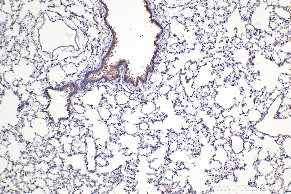 IHC staining of rat lung using 67296-1-Ig (same clone as 67296-1-PBS) Immunohistochemistry (IHC) staining of rat lung tissue using DOCK1 Monoclonal antibody (67296-1-Ig)