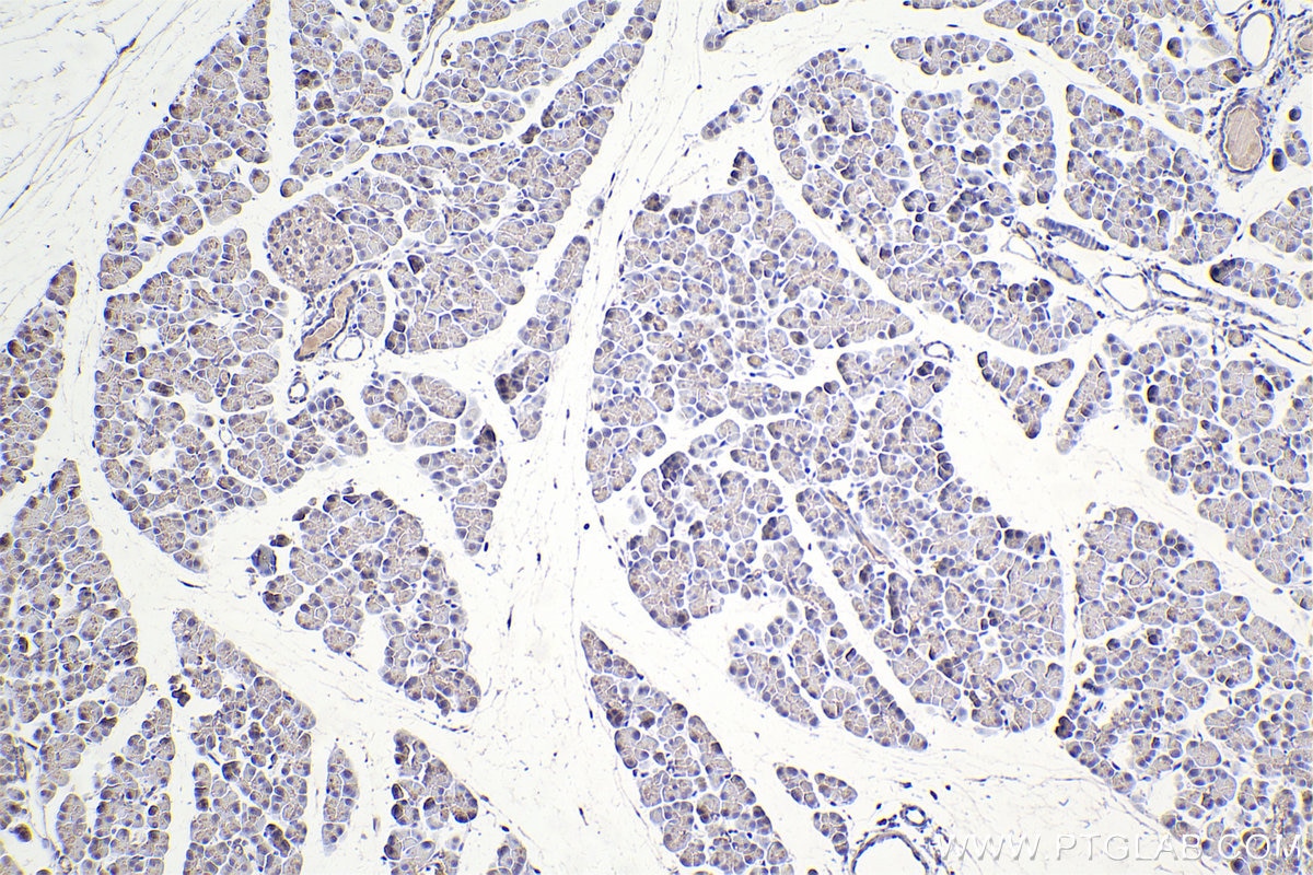 IHC staining of rat pancreas using 67296-1-Ig (same clone as 67296-1-PBS) Immunohistochemistry (IHC) staining of rat pancreas tissue using DOCK1 Monoclonal antibody (67296-1-Ig)