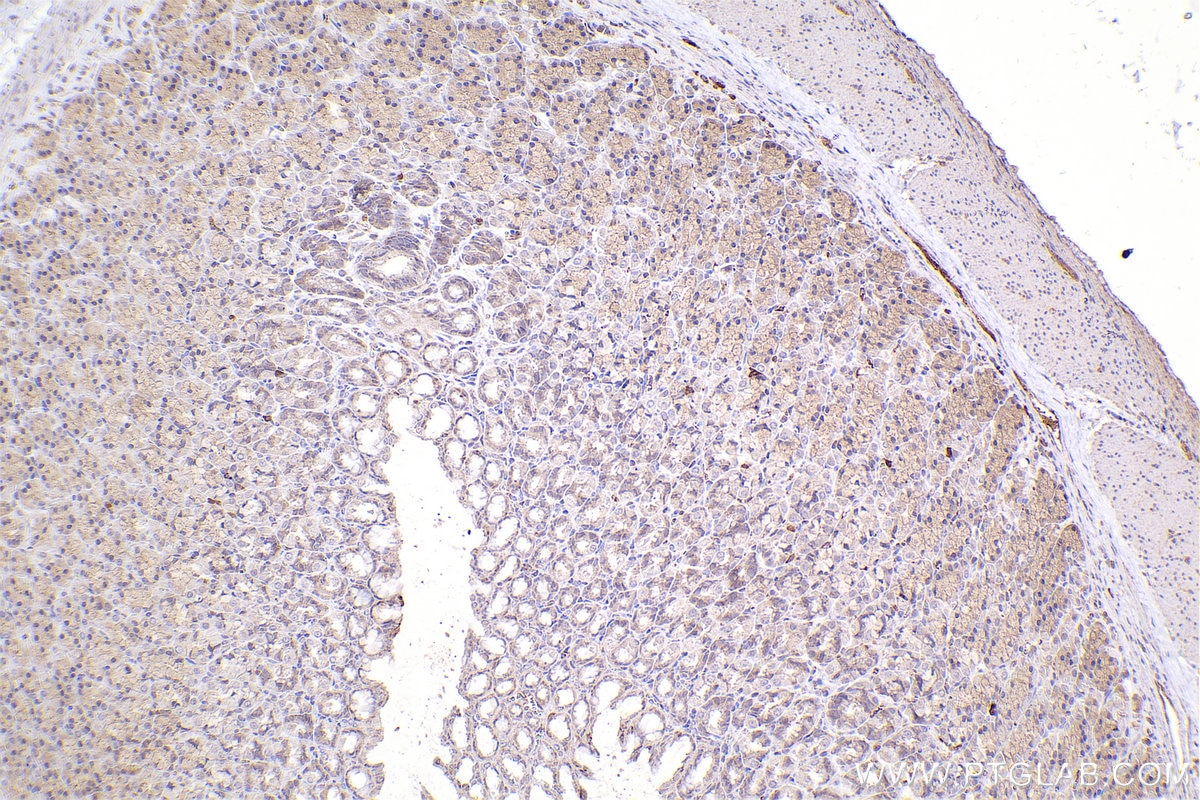 IHC staining of rat stomach using 67296-1-Ig (same clone as 67296-1-PBS) Immunohistochemistry (IHC) staining of rat stomach tissue using DOCK1 Monoclonal antibody (67296-1-Ig)