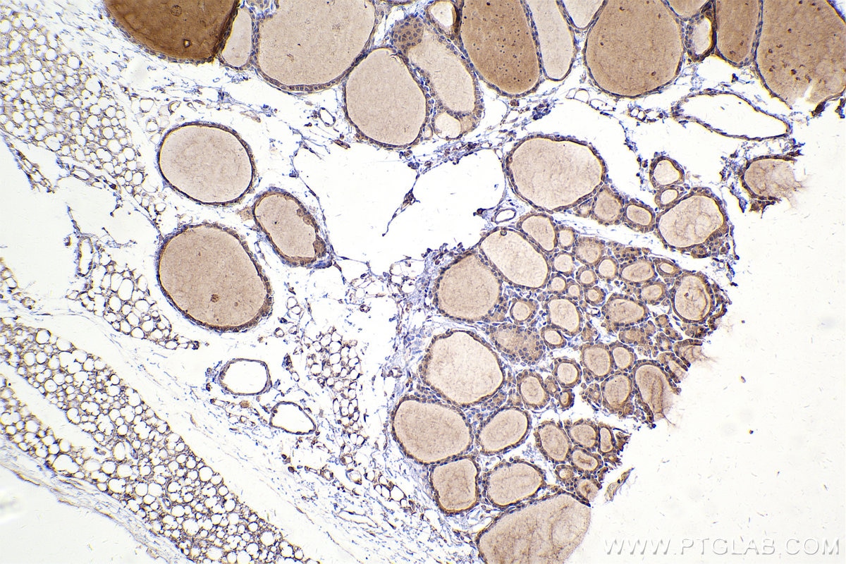 IHC staining of rat thyroid gland using 67296-1-Ig (same clone as 67296-1-PBS) Immunohistochemistry (IHC) staining of rat thyroid gland tissue using DOCK1 Monoclonal antibody (67296-1-Ig)