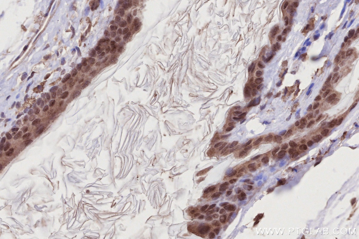 Immunohistochemistry (IHC) staining of mouse skin tissue using DOCK10 Polyclonal antibody (16834-1-AP)