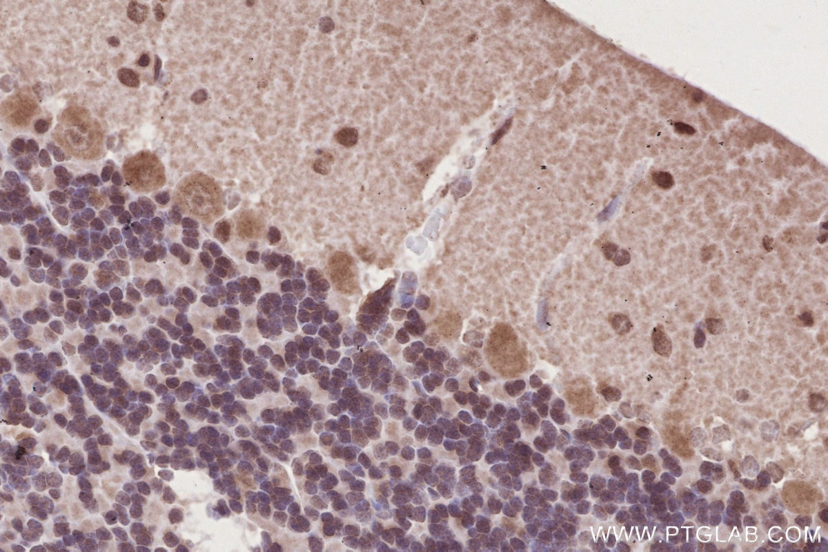 Immunohistochemistry (IHC) staining of rat cerebellum tissue using DOCK10 Polyclonal antibody (16834-1-AP)