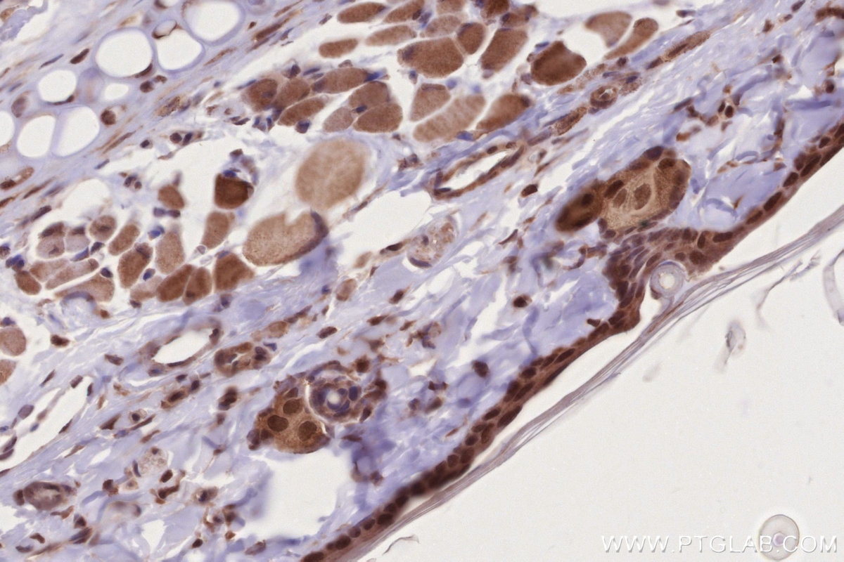 Immunohistochemistry (IHC) staining of rat skin tissue using DOCK10 Polyclonal antibody (16834-1-AP)