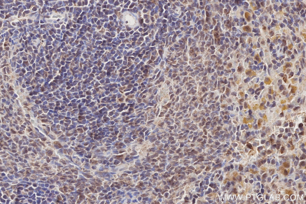 Immunohistochemistry (IHC) staining of rat spleen tissue using DOCK10 Polyclonal antibody (16834-1-AP)