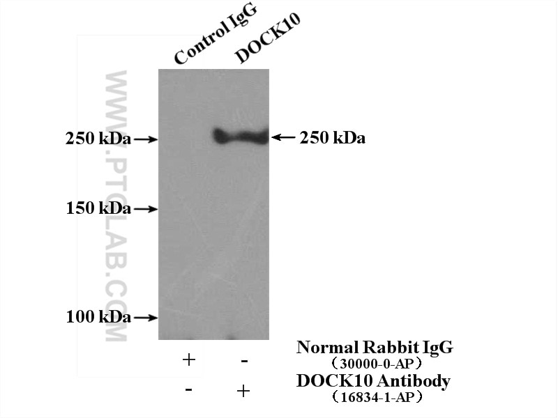 Immunoprecipitation (IP) experiment of HeLa cells using DOCK10 Polyclonal antibody (16834-1-AP)