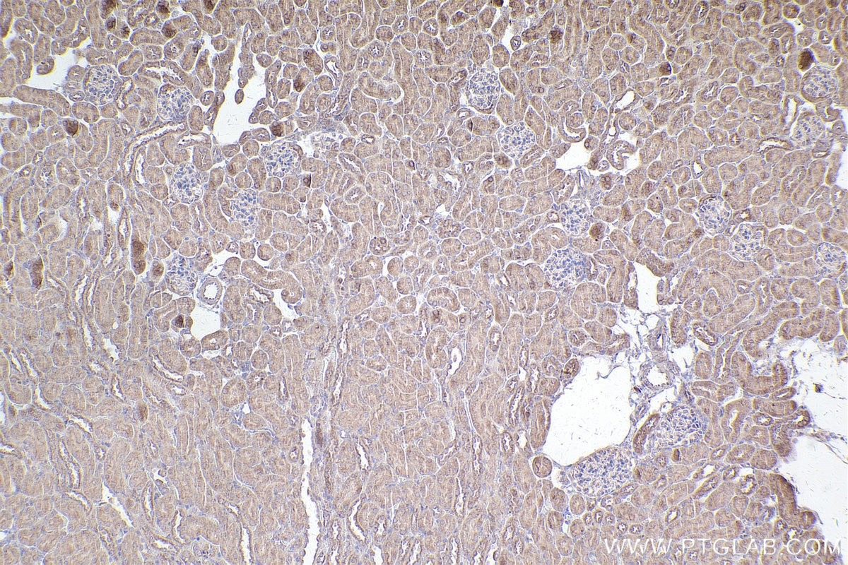 Immunohistochemistry (IHC) staining of mouse kidney tissue using DOCK11 Polyclonal antibody (31993-1-AP)