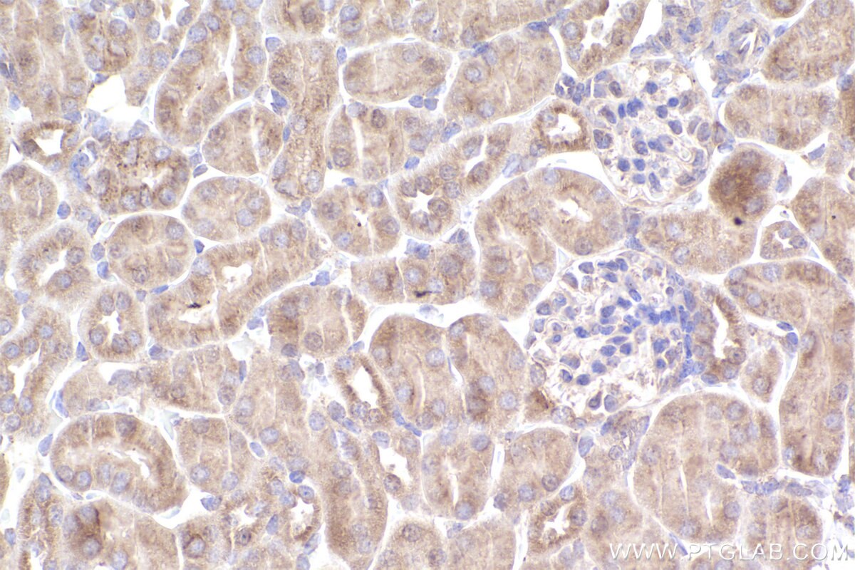Immunohistochemistry (IHC) staining of mouse kidney tissue using DOCK11 Polyclonal antibody (31993-1-AP)