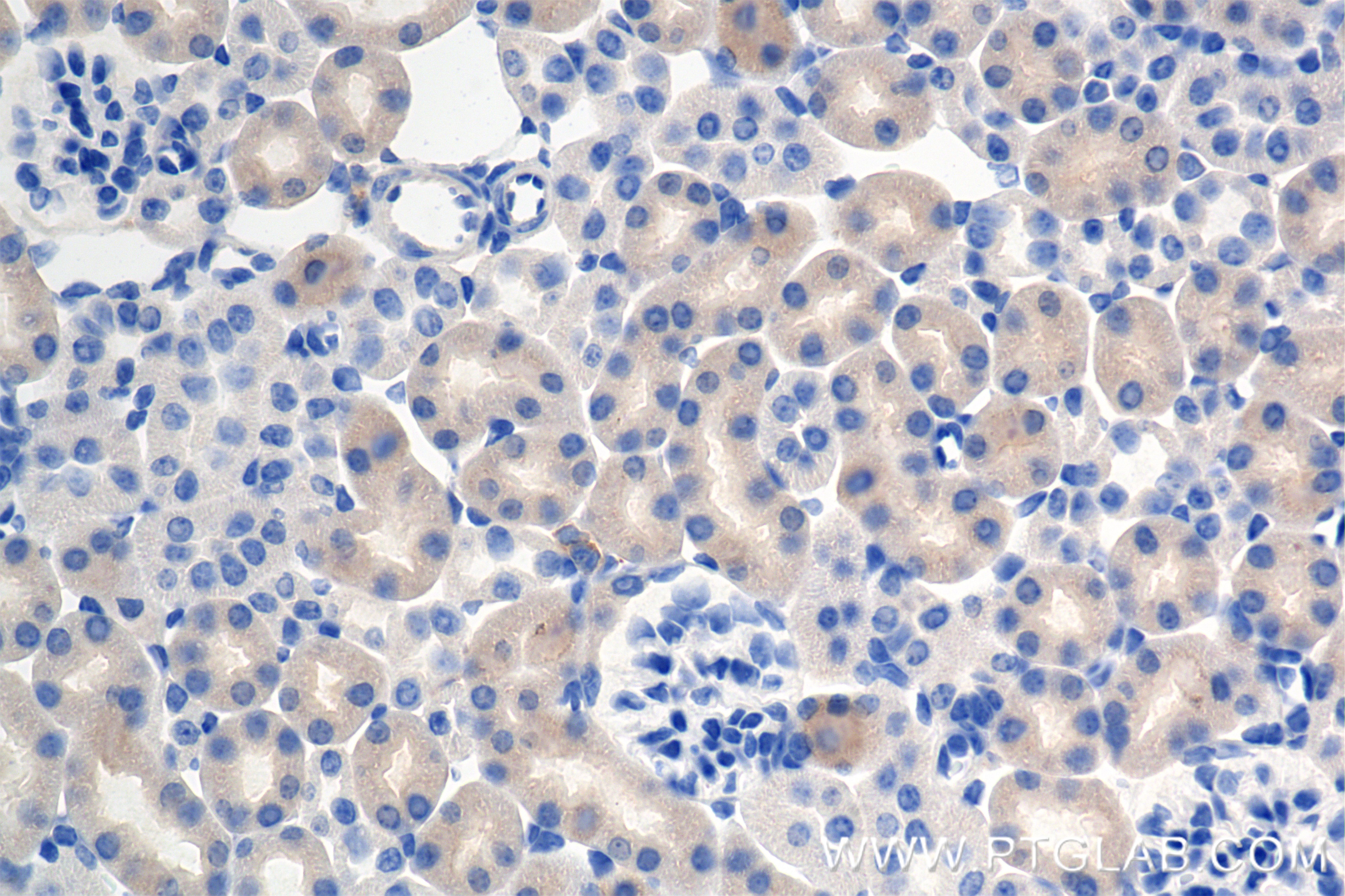 Immunohistochemical analysis of paraffin-embedded mouse kidney tissue slide using 85022-3-RR (DOCK11 antibody) at dilution of 1:500 (under 40x lens). Heat mediated antigen retrieval with Tris-EDTA buffer (pH 9.0). This data was developed using the same antibody clone with 85022-3-PBS in a different storage buffer formulation. Immunohistochemistry (IHC) staining of mouse kidney tissue using DOCK11 Recombinant antibody (85022-3-RR)