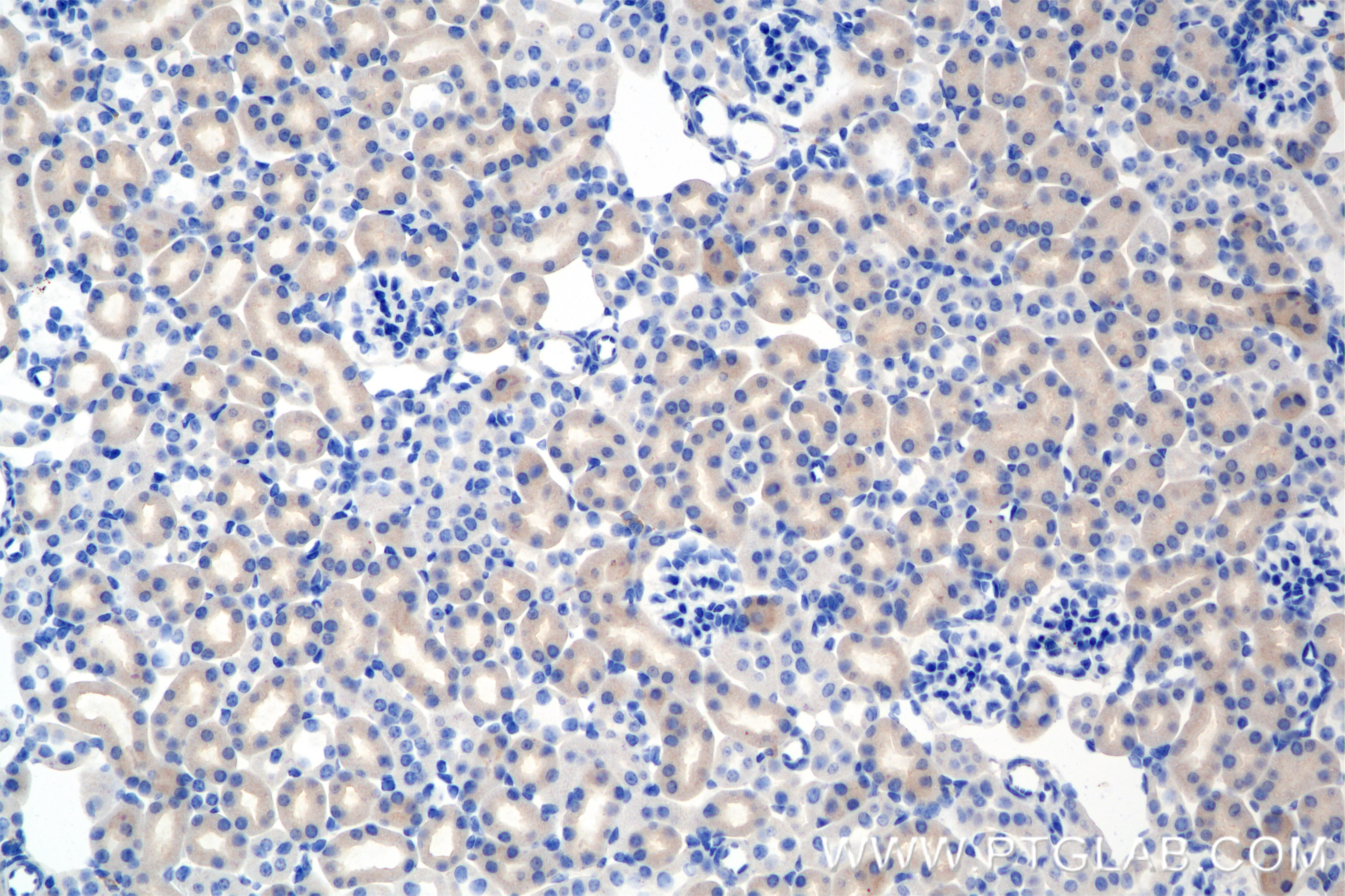 Immunohistochemical analysis of paraffin-embedded mouse kidney tissue slide using 85022-3-RR (DOCK11 antibody) at dilution of 1:500 (under 20x lens). Heat mediated antigen retrieval with Tris-EDTA buffer (pH 9.0). This data was developed using the same antibody clone with 85022-3-PBS in a different storage buffer formulation. Immunohistochemistry (IHC) staining of mouse kidney tissue using DOCK11 Recombinant antibody (85022-3-RR)