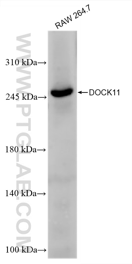 Western Blot (WB) analysis of various lysates using DOCK11 Recombinant antibody (85022-3-RR)