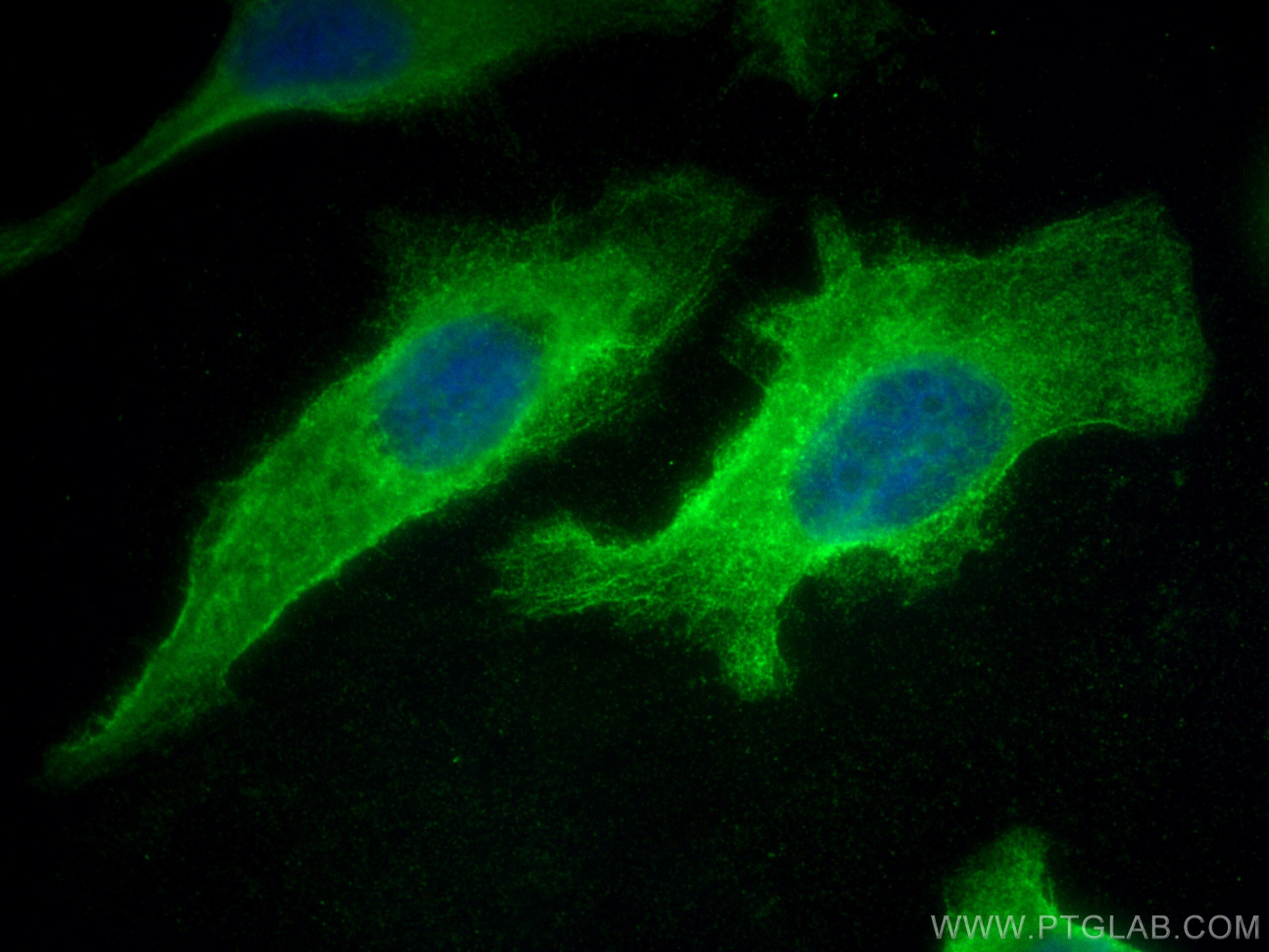 Immunofluorescence (IF) / fluorescent staining of HeLa cells using DOCK2 Monoclonal antibody (66969-1-Ig)