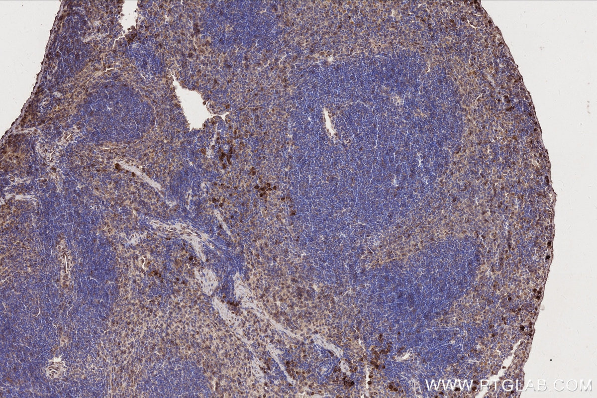 Immunohistochemistry (IHC) staining of mouse spleen tissue using DOCK2 Monoclonal antibody (66969-1-Ig)