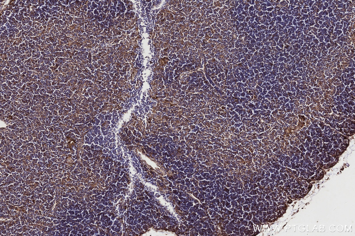 Immunohistochemistry (IHC) staining of mouse thymus tissue using DOCK2 Monoclonal antibody (66969-1-Ig)