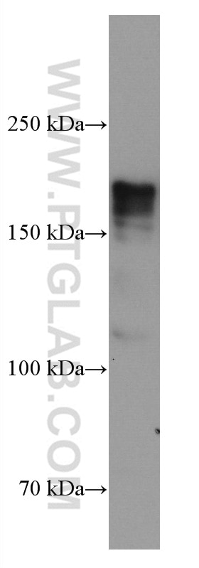 Western Blot (WB) analysis of HeLa cells using DOCK2 Monoclonal antibody (66969-1-Ig)