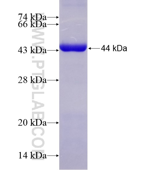 DOCK2 fusion protein Ag28582 SDS-PAGE