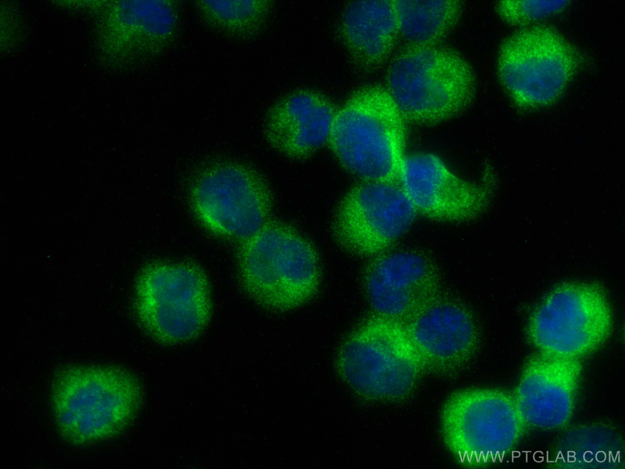 Immunofluorescence (IF) / fluorescent staining of Jurkat cells using DOCK2-Specific Polyclonal antibody (20245-1-AP)