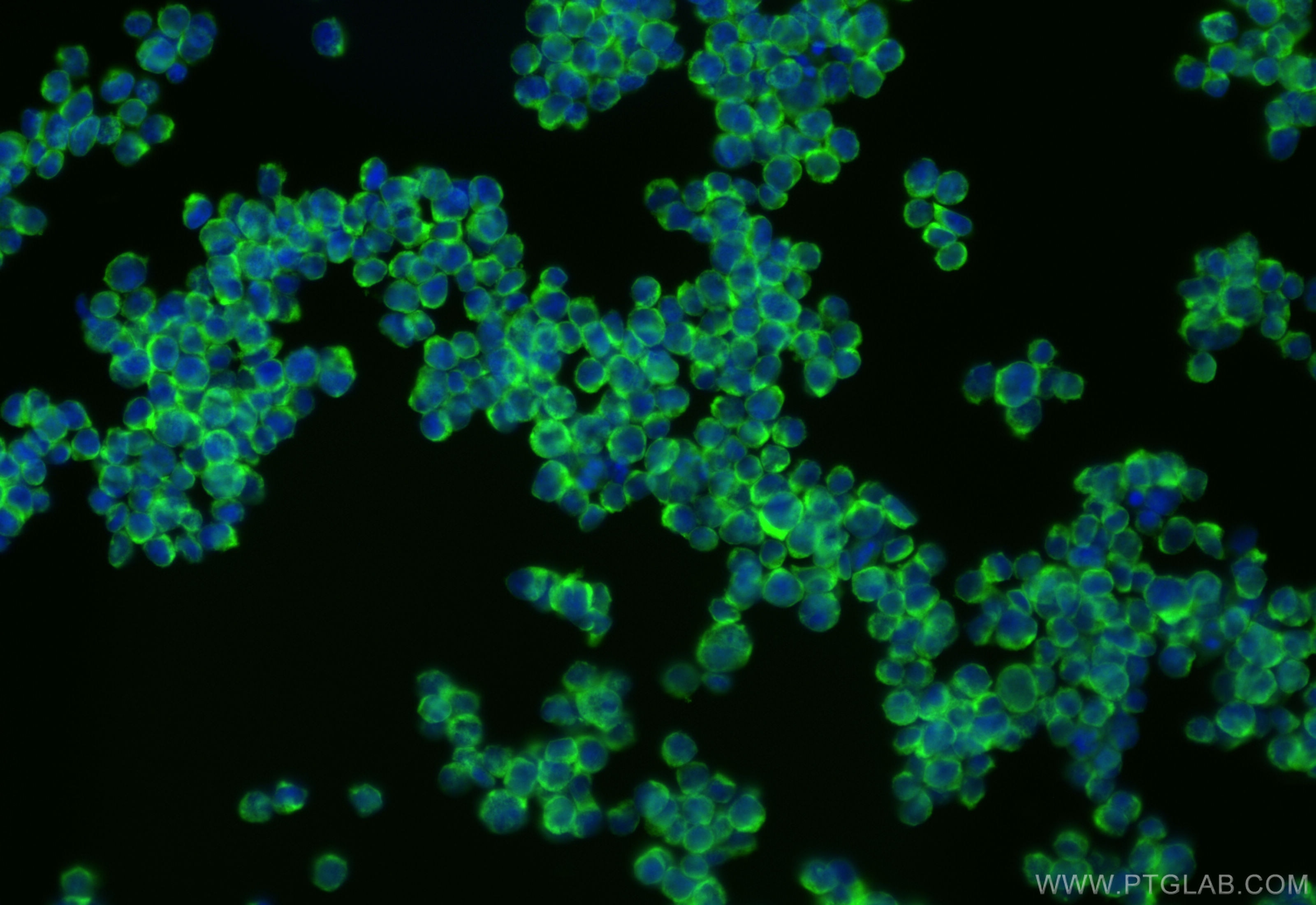 Immunofluorescence (IF) / fluorescent staining of Jurkat cells using CoraLite® Plus 488-conjugated DOCK2-Specific Recom (CL488-84548)