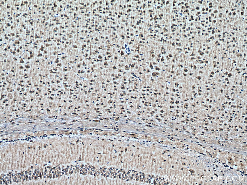 Immunohistochemistry (IHC) staining of mouse brain tissue using DOCK3; MOCA Polyclonal antibody (20683-1-AP)