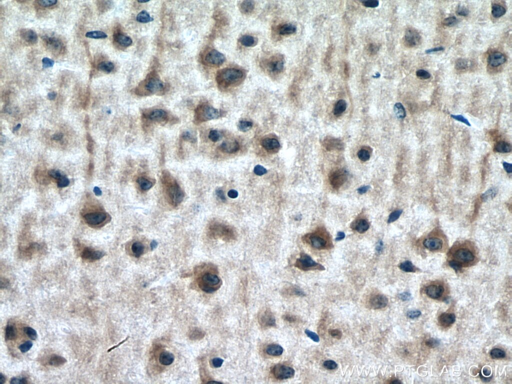 Immunohistochemistry (IHC) staining of mouse brain tissue using DOCK3; MOCA Polyclonal antibody (20683-1-AP)