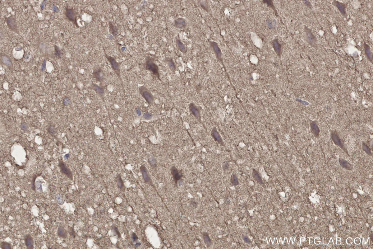 Immunohistochemistry (IHC) staining of mouse brain tissue using DOCK3; MOCA Polyclonal antibody (20683-1-AP)