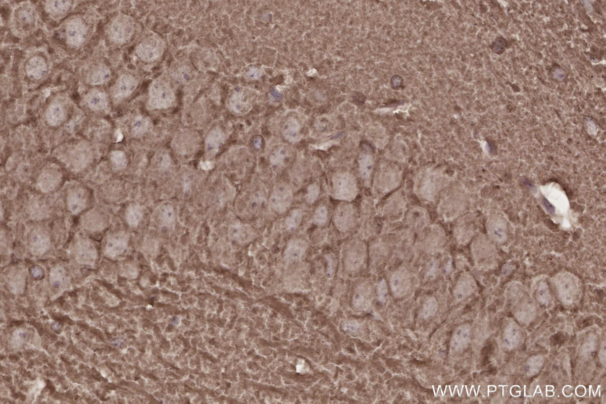 Immunohistochemistry (IHC) staining of mouse brain tissue using DOCK3; MOCA Polyclonal antibody (20683-1-AP)
