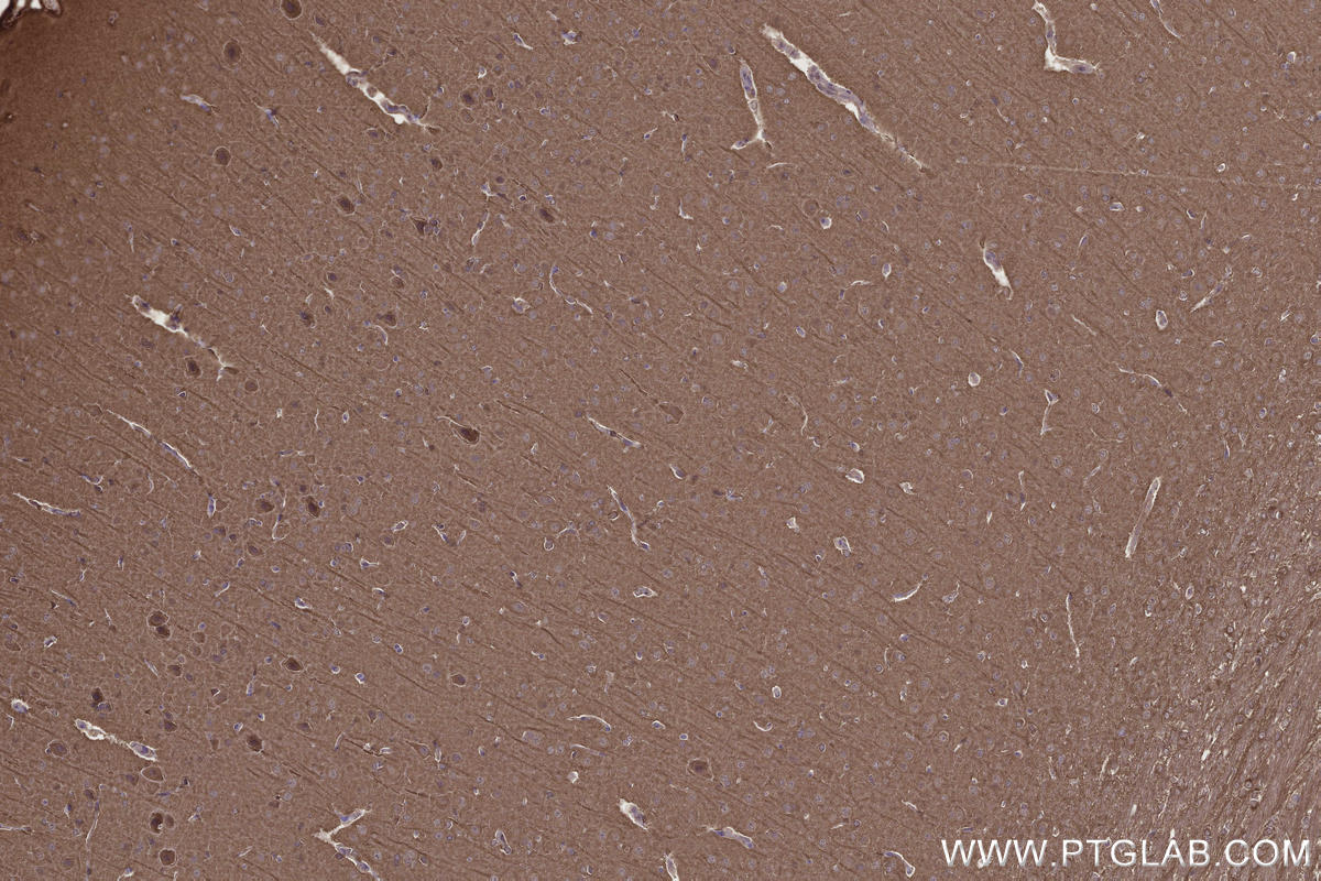 Immunohistochemistry (IHC) staining of rat brain tissue using DOCK3; MOCA Polyclonal antibody (20683-1-AP)