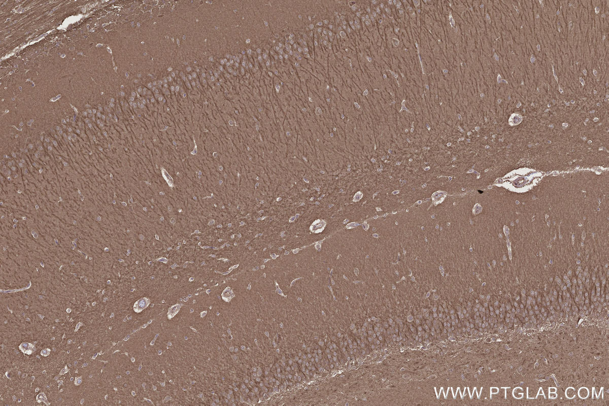 Immunohistochemistry (IHC) staining of rat brain tissue using DOCK3; MOCA Polyclonal antibody (20683-1-AP)