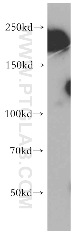 Western Blot (WB) analysis of human brain tissue using DOCK3; MOCA Polyclonal antibody (20683-1-AP)