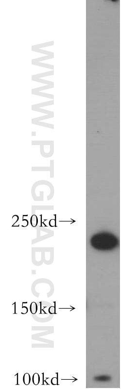 Western Blot (WB) analysis of SH-SY5Y cells using DOCK3; MOCA Polyclonal antibody (20683-1-AP)