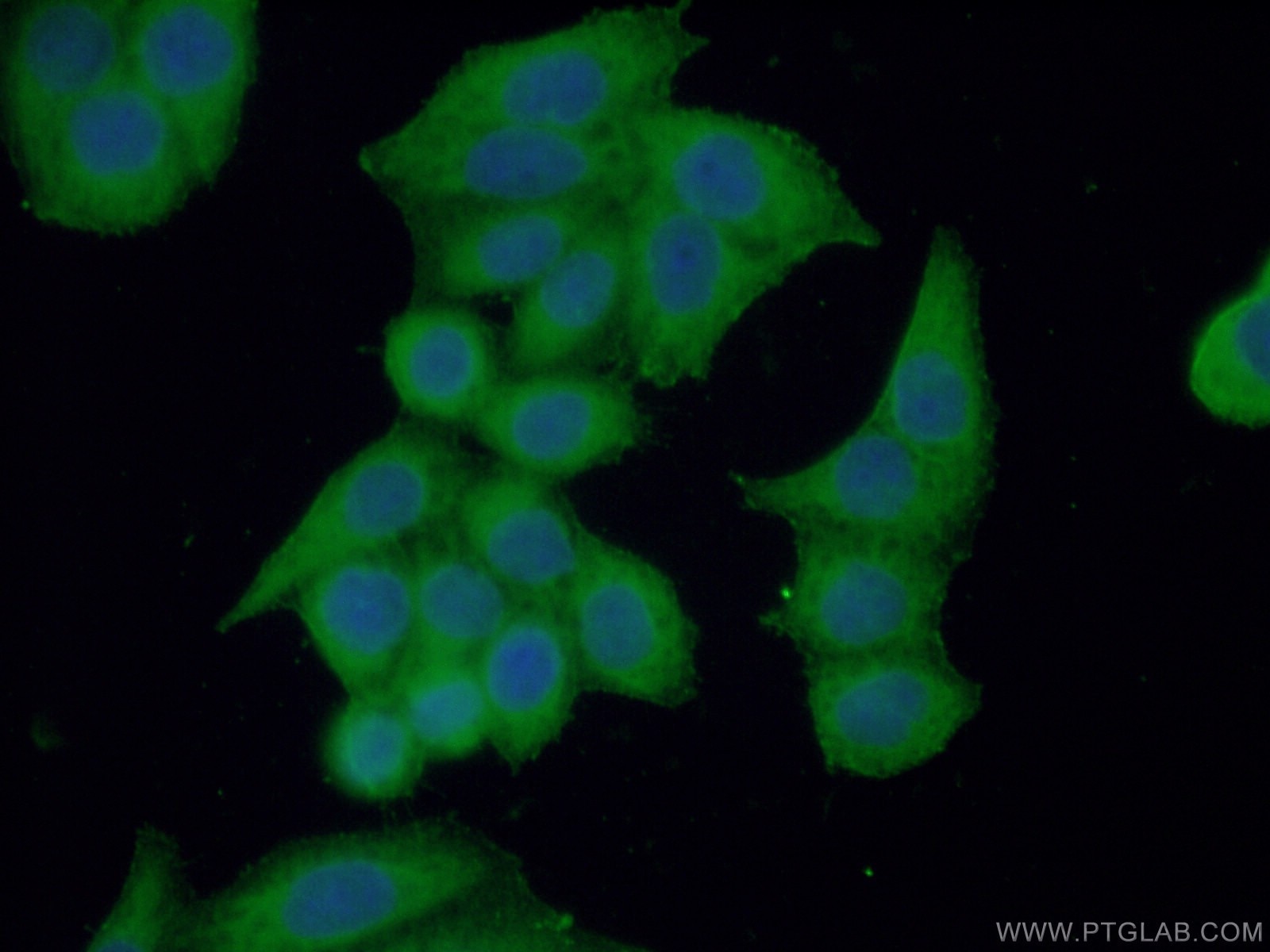 Immunofluorescence (IF) / fluorescent staining of HeLa cells using DOCK4 Polyclonal antibody (21861-1-AP)