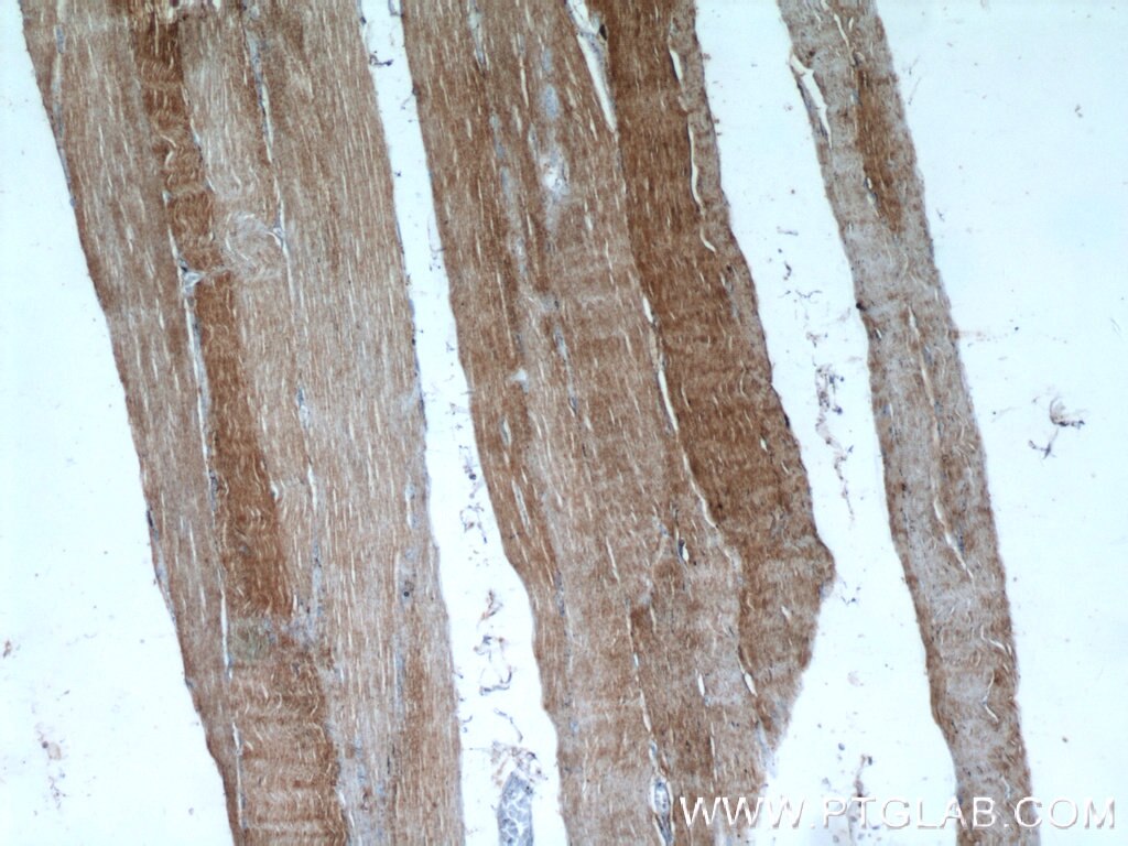 IHC staining of human skeletal muscle using 21861-1-AP