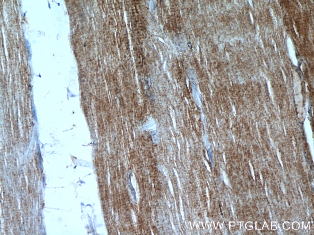 Immunohistochemistry (IHC) staining of human skeletal muscle tissue using DOCK4 Polyclonal antibody (21861-1-AP)